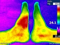 Fuß Wärmestrahlung Infrarot.jpg